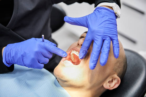 Best Emergency Root Canal Treatment in Farmville, NC